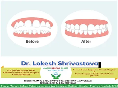 Dr. Lokesh Shrivastava Gwalior (Dentist)